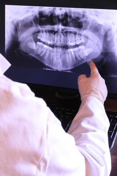 Best Emergency Dental Surgery in Claremont, NH