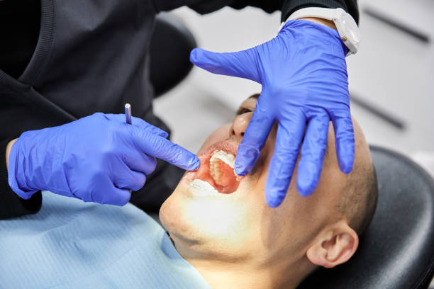 Best Emergency Tooth Extraction in Claremont, NH