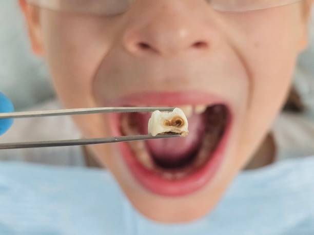 Best Emergency Treatment for Toothache in Claremont, NH