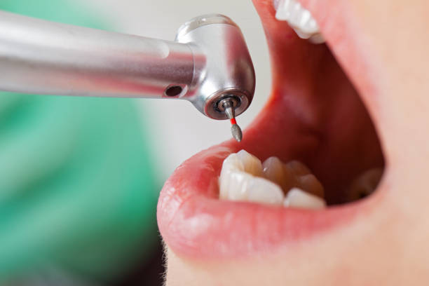 Best Walk-In Emergency Dentist in Claremont, NH